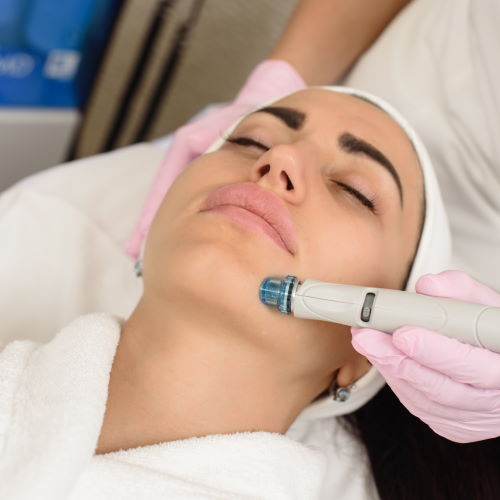 Microdermabrasion in Verrado, AZ