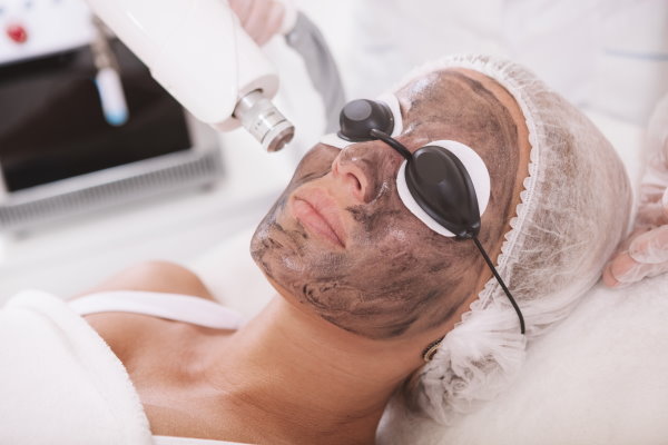 Carbon Laser Facial in Buckeye, AZ